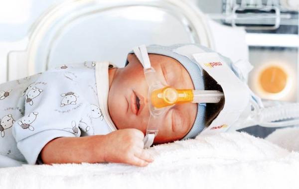 beatmung_neonatologie